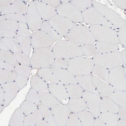 INF2 Antibody, Novus Biologicals 0.1mL; Unlabeled:Antibodies, Polyclonal